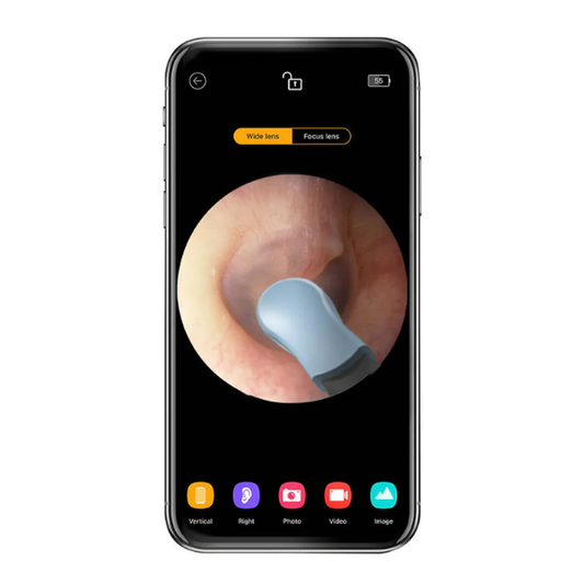 EarScope Pro™ - Professional Ear Wax Removal Tool With Camera