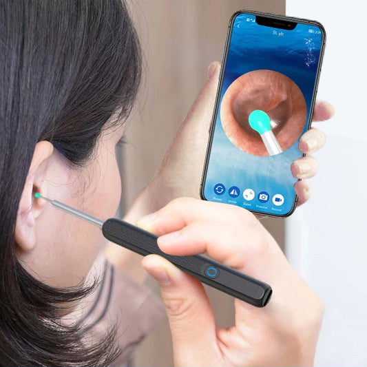 EarScope Pro™ - Professional Ear Wax Removal Tool With Camera
